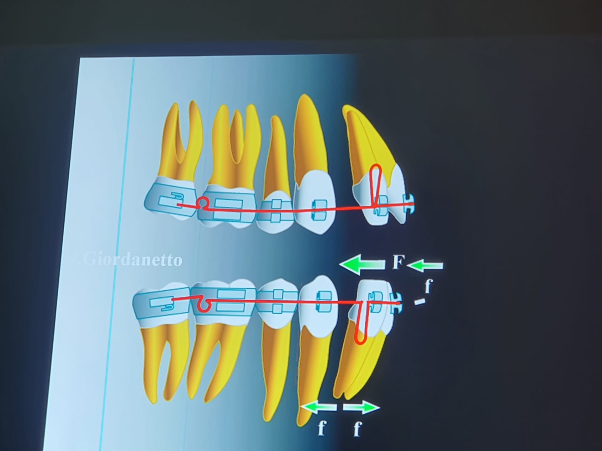 Formação Biomecânica Avançada Setembro/Outubro2020
